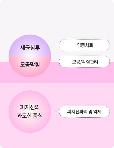 ニキビ治療施術イメージ