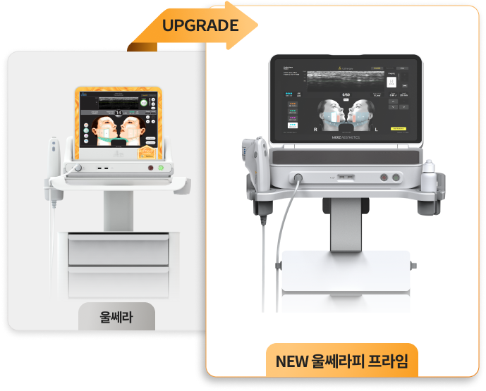 ウルセラピー プライム アップグレード機器イメージ